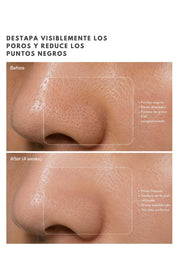 Suero Exfoliante BHA 2%