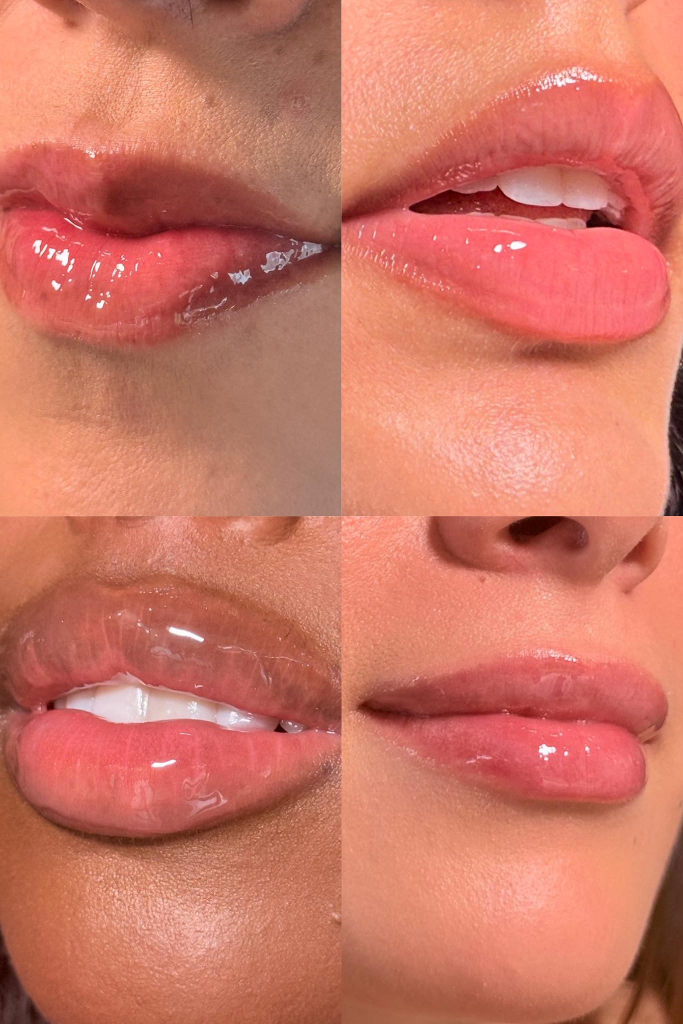 Lip Sérum Voluminizador con Péptidos