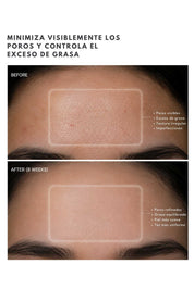 Suero de Niacinamida