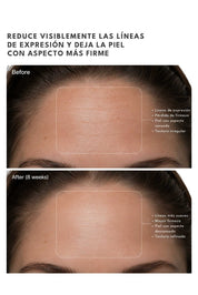 Suero Multipéptidos