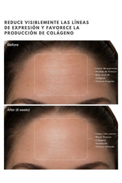 Suero Multipéptidos