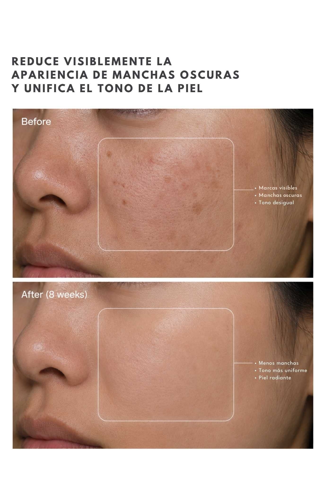 Suero Iluminador TRX