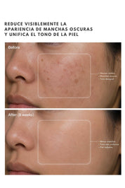 Suero Iluminador TRX