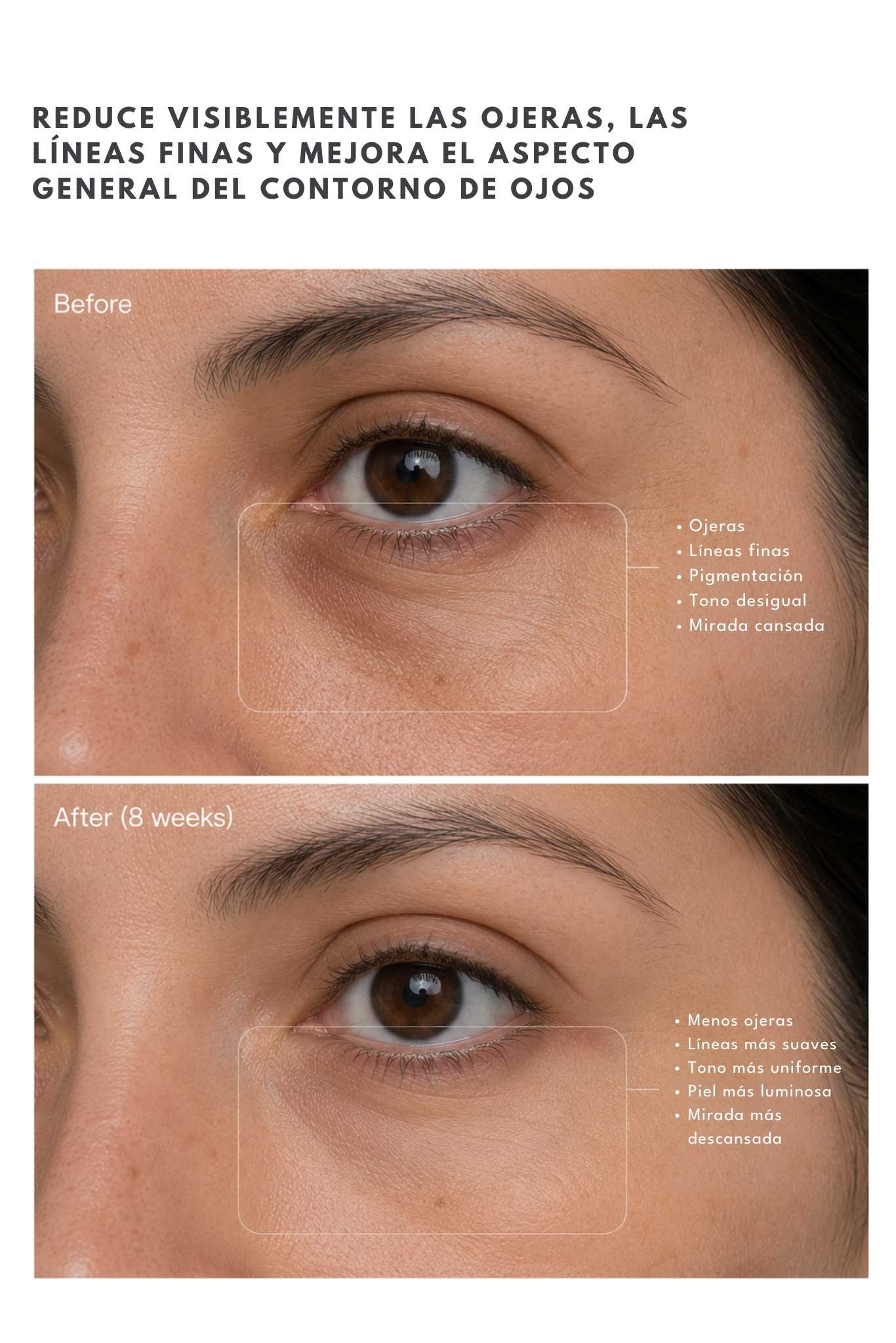Contorno de Ojos Con Retinal