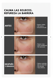Before/After Esencia de Centella Asiática - Calma rojeces y refuerza la barrera