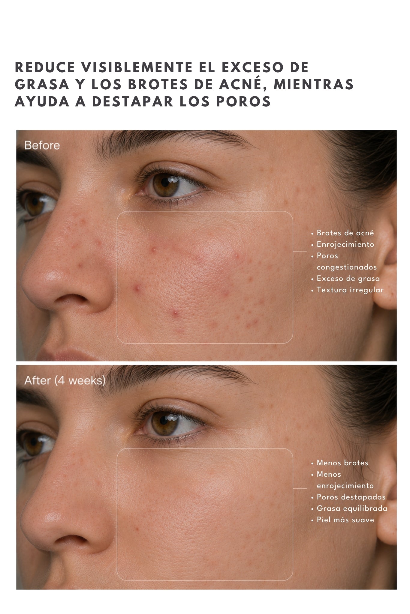Limpiador Facial BHA 2%
