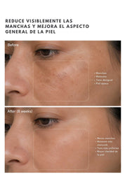Suero Exfoliante Nova-PHA